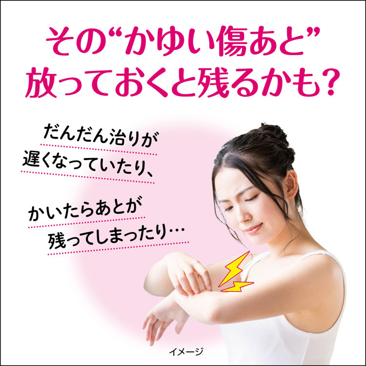 小林製藥 Attonon EXk Plus傷口/燙傷疤痕止癢修復軟膏 10g【第2類醫藥品】
