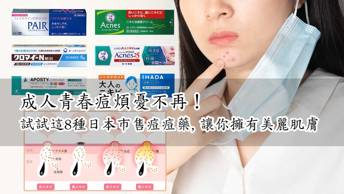 【2023日本藥妝必買】成人青春痘告別計畫：10款日本明星痘痘藥，找回自信美肌！ - 小熊藥妝 - 日本藥妝直送台灣