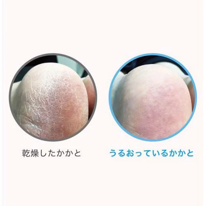 Nature Conc 藥用足部角質柔潤塗抹液 40ml